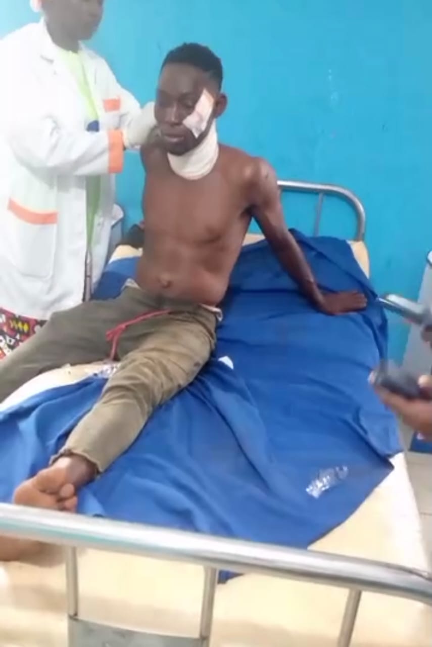 Des blessés grave ont été enregistrés